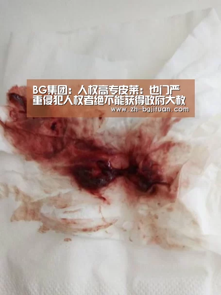 BG集团:人权高专皮莱:也门严重侵犯人权者绝不能获得政府大赦(图2) BG集团